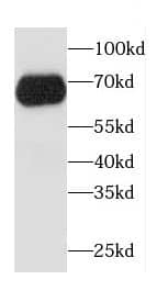 CCDC9 Antibody - BSA Free