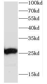 CCDC85B Antibody - BSA Free