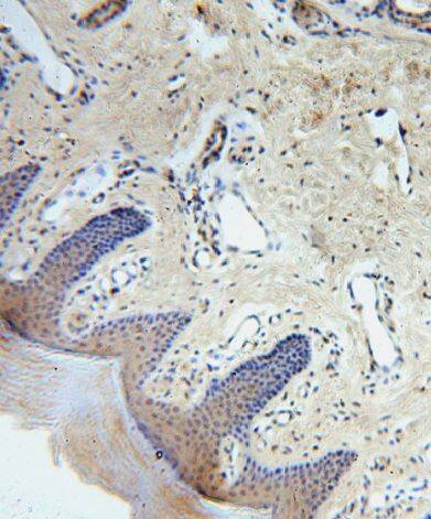 CCDC72 Antibody - BSA Free