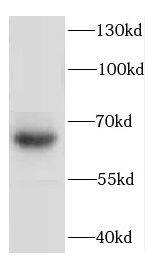 CCDC67 Antibody - BSA Free