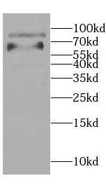 CCDC41 Antibody - BSA Free