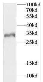 CCDC28B Antibody - BSA Free