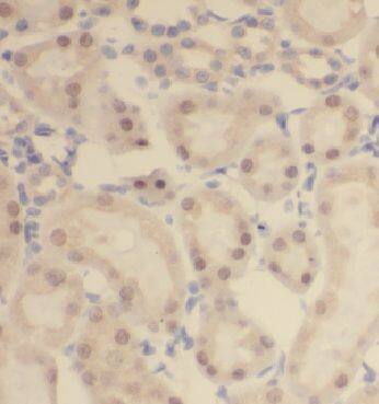 CCDC27 Antibody - BSA Free
