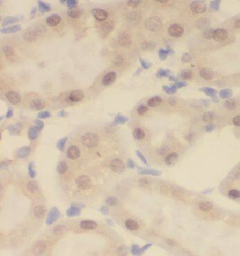 CCDC25 Antibody - BSA Free