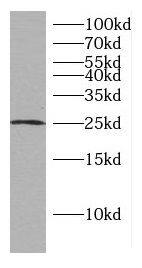 CCDC25 Antibody - BSA Free
