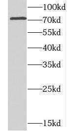 CCDC22 Antibody - BSA Free