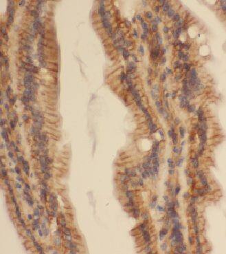 CCDC120 Antibody - BSA Free