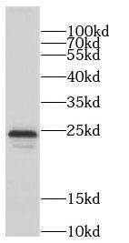 CCDC115 Antibody - BSA Free