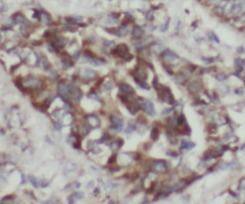 CC2D2A Antibody - BSA Free
