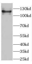 CC2D1B Antibody - BSA Free