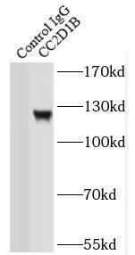 CC2D1B Antibody - BSA Free