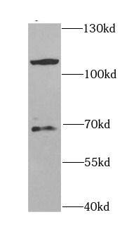 CBLB Antibody - BSA Free