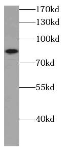 ATPGD1 Antibody - BSA Free
