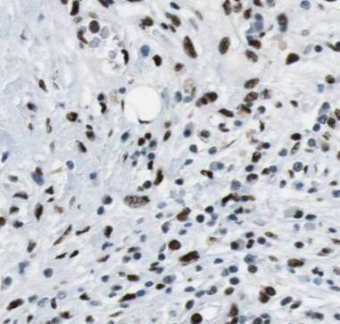 CPA6 Antibody - BSA Free