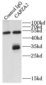 CAPZA2 Antibody - BSA Free