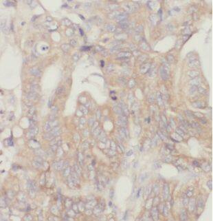 CAPZA2 Antibody - BSA Free