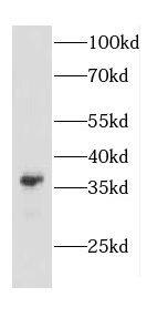 CAPZA2 Antibody - BSA Free