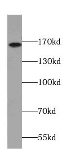 CAMSAP1L1 Antibody - BSA Free