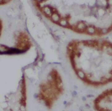 CAMSAP1L1 Antibody - BSA Free