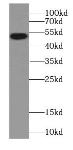 CAPS2 Antibody - BSA Free