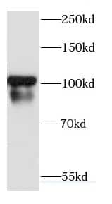 Cadherin-18 Antibody - BSA Free