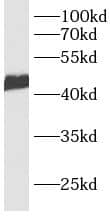 CACNG7 Antibody - BSA Free