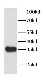 CACNG5 Antibody - BSA Free