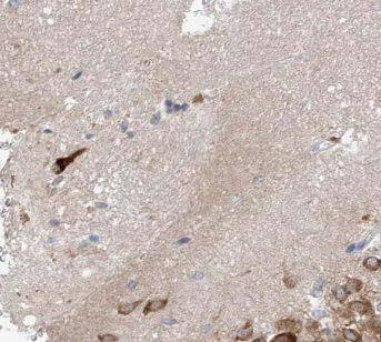 Stargazin Antibody - BSA Free