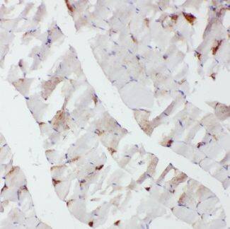 CACNA1S Antibody - BSA Free