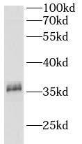 CA11 Antibody - BSA Free