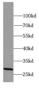 EQTN Antibody - BSA Free