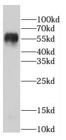 TTI2 Antibody - BSA Free