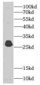 MALSU1 Antibody - BSA Free