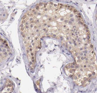 MALSU1 Antibody - BSA Free