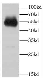 ARMT1 Antibody - BSA Free