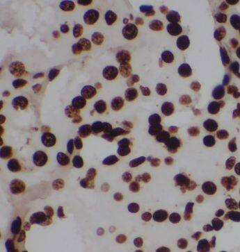 OARD1 Antibody - BSA Free