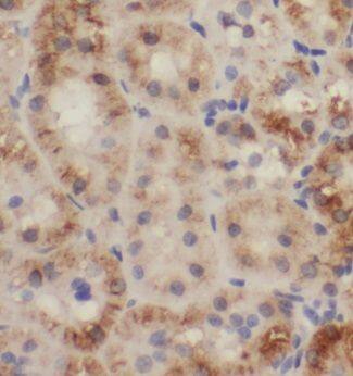 TRAPPC13 Antibody - BSA Free