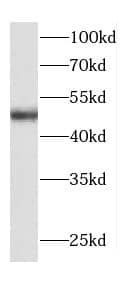 TRAPPC13 Antibody - BSA Free