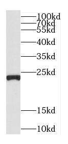 C5orf24 Antibody - BSA Free