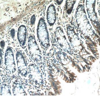 ABHD18 Antibody - BSA Free