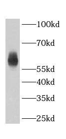 ABHD18 Antibody - BSA Free