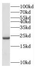 HSD5 Antibody - BSA Free