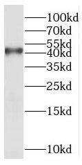 XXYLT1 Antibody - BSA Free