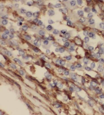 BRICK1 Antibody - BSA Free