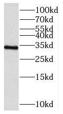 C21orf59 Antibody - BSA Free