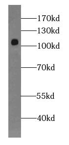 MIS18A Antibody - BSA Free