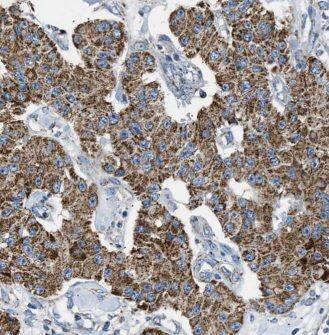 TMEM230 Antibody - BSA Free