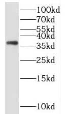 FNDC11 Antibody - BSA Free