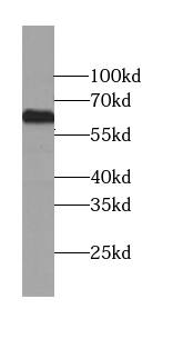LRRC71 Antibody - BSA Free