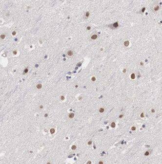 TCEANC2 Antibody - BSA Free